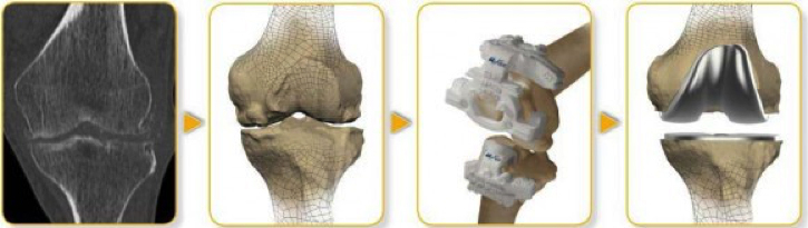 Knee_Diagram