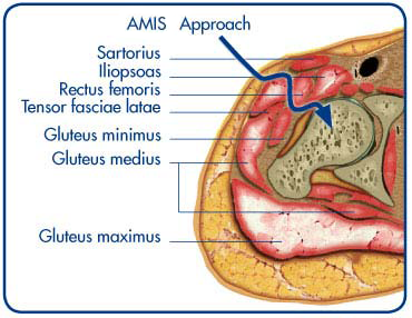 Hip anatomy